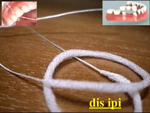 Diş ipi